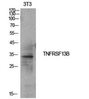 Polyclonal Rabbit anti-Human TNFRSF13B / TACI Antibody (WB)