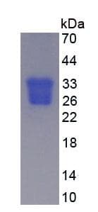 Human OSM / Oncostatin M Protein (Recombinant)
