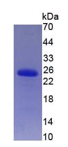 Human TIMP2 Protein (Recombinant)