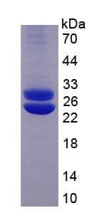 Human PRL / Prolactin Protein (Recombinant)