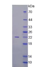 Human Activin A Protein (Recombinant His-S)