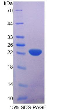 Mouse IL-10 Protein (Recombinant His-S)