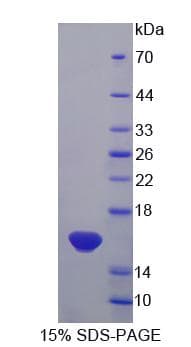 Rat IL13 Protein (Recombinant His-S)