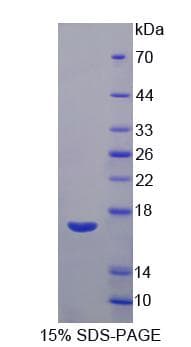 Bovine VEGFB Protein (Recombinant His-S)