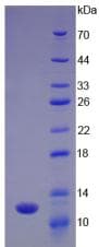 Ubiquitin Protein (Recombinant His)