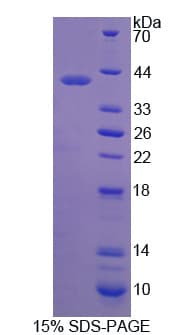 Human MMP23 Protein (Recombinant His)