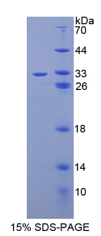 Human CASP14 / Caspase 14 Protein (Recombinant His-T7)