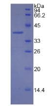 Human MBP / Myelin Basic Protein (Recombinant His-GST)
