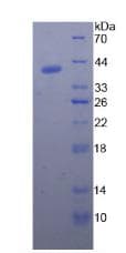 Pig NPPB / BNP Protein (Recombinant His-GST)