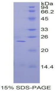 Human TIMP1 Protein (Recombinant His)