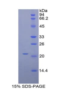 Mouse HDGF Protein (Recombinant His)