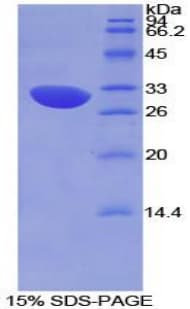 Mouse CFH / Complement Factor H Protein (Recombinant His-T7)