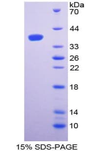Rat Complement C3 Protein (Recombinant His)