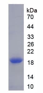 Mouse DPP4 / CD26 Protein (Recombinant His)