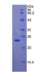Human TP / Thymidine Phosphorylase Protein (Recombinant His)