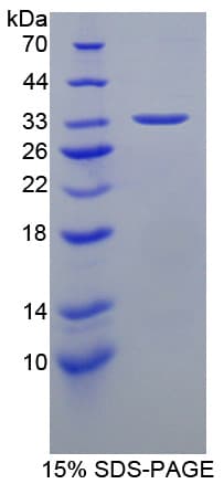Mouse HSF4 Protein (Recombinant His-T7)