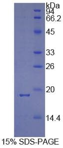 Human PPIA / Cyclophilin A Protein (Recombinant His)