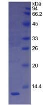Human VTN / Vitronectin Protein (Recombinant His)