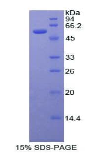 Rat ER Alpha / Estrogen Receptor Protein (Recombinant His-GST)