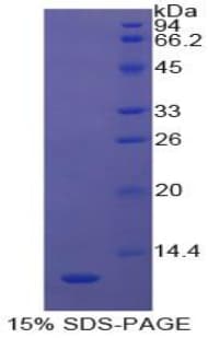 Bovine PIGR Protein (Recombinant His)