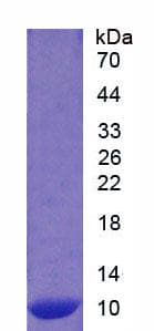 Human S100A12 Protein (Recombinant His)