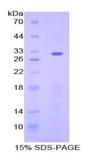 Mouse CD39 Protein (Recombinant His-T7)