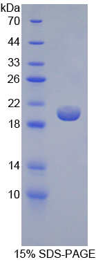 Human GCKR Protein (Recombinant His)