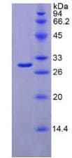 Mouse IFNAR1 / IFNAR Protein (Recombinant His)