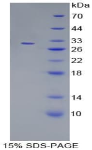 Mouse MAPK7 / ERK5 Protein (Recombinant His-T7)