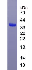 Human EGR2 Protein (Recombinant His-T7)