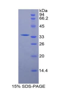 Human OTC Protein (Recombinant His-T7)
