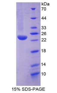 Human TNFRSF1A / TNFR1 Protein (Recombinant His-T7)