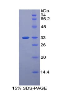 Mouse CD157 Protein (Recombinant His-T7)