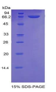 Human ITGB2 / CD18 Protein (Recombinant His-MBP)