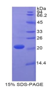 Human CASP1 / Caspase 1 Protein (Recombinant His)