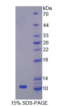 Human CASP1 / Caspase 1 Protein (Recombinant His)