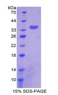 Human CS / Citrate Synthase Protein (Recombinant His-T7)