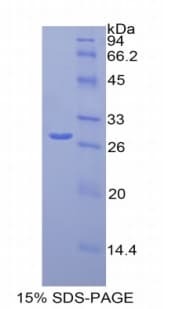 Human MCAM / CD146 Protein (Recombinant His)