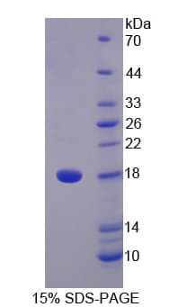 Human STAT5A Protein (Recombinant His)
