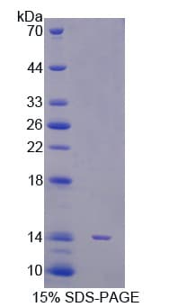 Human STAT5A Protein (Recombinant His, N-Terminal)