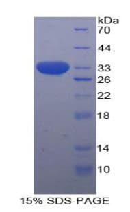 Human STAT1 Protein (Recombinant His-T7)