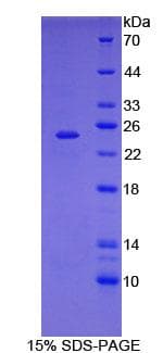 STAT3 Protein (Recombinant His)