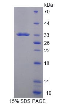 Mouse CD19 Protein (Recombinant His-T7)