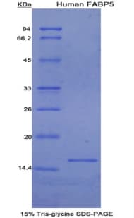Human E-FABP / FABP5 Protein (Recombinant His)