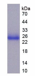 Human TLR5 Protein (Recombinant His-S)