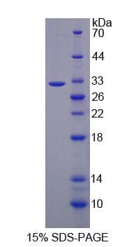 Human DPYD / DPD Protein (Recombinant His-S)