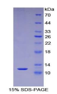 Human S100A5 Protein (Recombinant His)