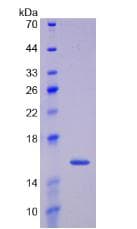 Human GDF15 Protein (Recombinant His)