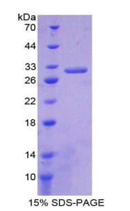 Mouse MKI67 / Ki67 Protein (Recombinant His-T7)