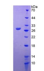 Human MMP14 Protein (Recombinant His-T7)